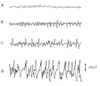 Fig_1_eeg_ok_3